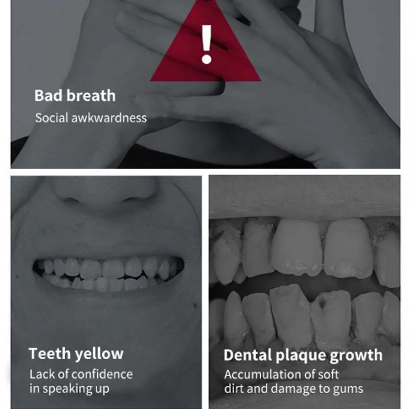 Ultra Whitening Fresh Probiotic Toothpaste