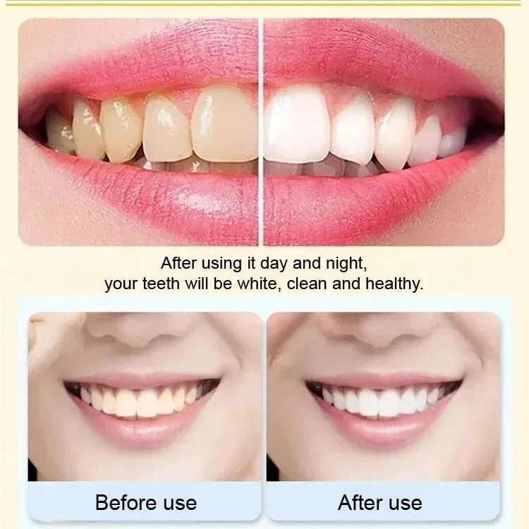 Ultra Whitening Fresh Probiotic Toothpaste